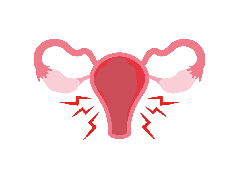 Een Franse start-up brengt een speekseltest uit om endometriose op te sporen