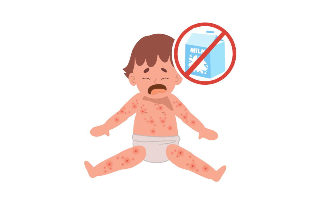 Alle producten geschikt voor baby’s met een koemelkallergie vergoed vanaf 1 juni