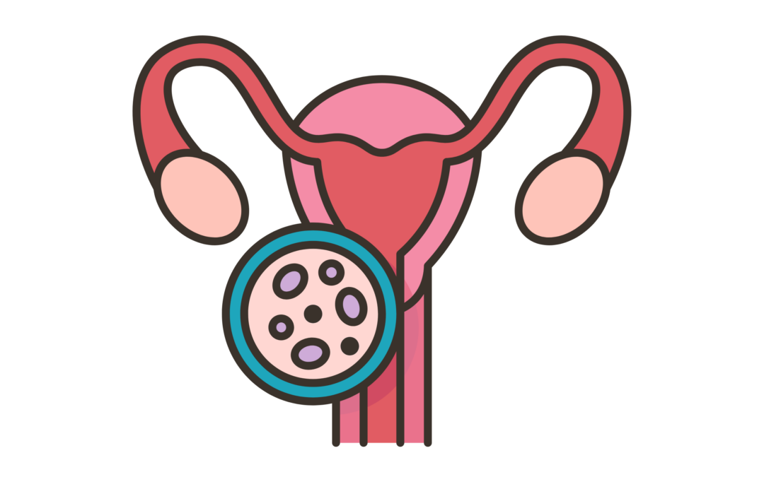Een veelbelovende probiotische behandeling van bacteriële vaginose