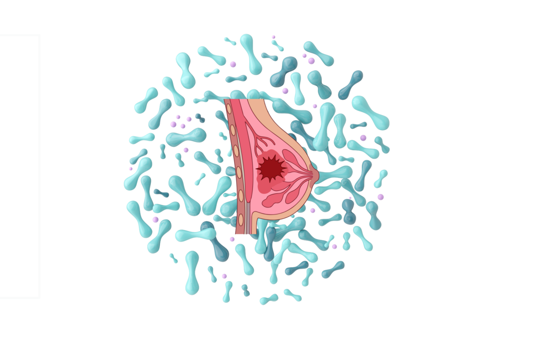 Borstkanker: zou de microbiota de reactie op behandelingen kunnen beïnvloeden?